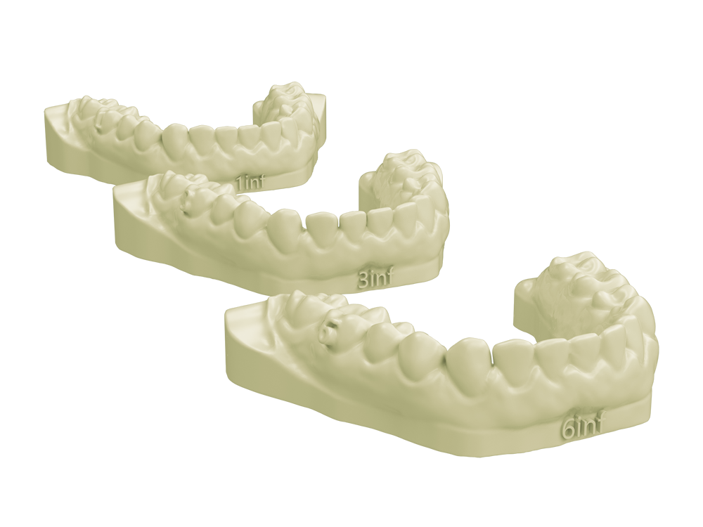 Modello Ortodontico